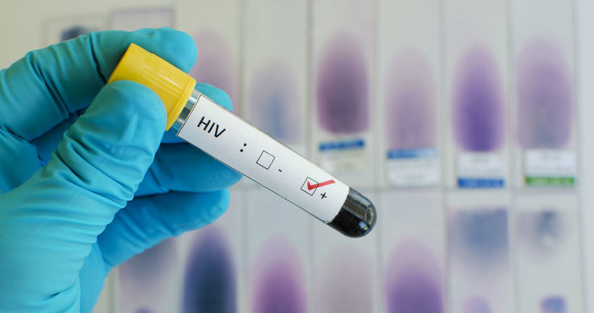 Jak dowiadujemy się z wyników badania opublikowanego w czasopiśmie naukowym Lancet HIV, powstrzymujący zakażenie wirusem HIV lek o nazwie PrEP okazał się wysoce skuteczną metodą leczenia zapobiegawczego w "rzeczywistym świecie".