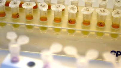 Światowa Agencja Antydopingowa odebrała akredytację laboratorium w Moskwie