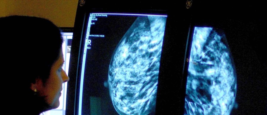 Ruszyła budowa centrum chorób piersi tzw. breast unit przy Dolnośląskim Centrum Onkologii we Wrocławiu. W poniedziałek samorząd województwa i władze placówki oficjalnie podpisały akt erekcyjny w tej sprawie. Inwestycja ma kosztować ok. 30 mln zł.