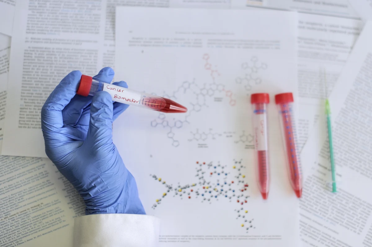 Szanse wyleczenia choroby nowotworowej znacznie rosną, jeśli diagnoza następuje dostatecznie wcześnie i szybko wprowadza się odpowiednią terapię. Problem w tym, że rozwijający się rak często bardzo długo nie daje żadnych objawów. Najnowsza praca naukowców z Instytutu Chemii Fizycznej PAN w Warszawie może pomóc w tworzeniu nowoczesnych testów, które dzięki prostym i tanim czujnikom mogą wczesną diagnostykę ułatwić. Pisze o tym czasopismo "Biosensors and Bioelectronics".