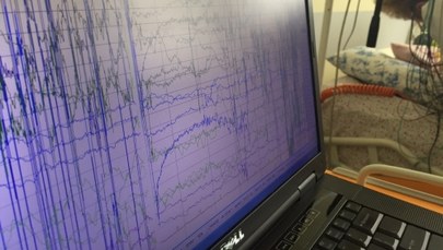 ​Badania kontrolne pacjentów w śpiączce po wszczepieniu stymulatorów. "Jest nadzieja"