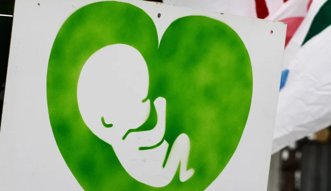 Sondaż: Czy Polacy chcą zmiany ustawy aborcyjnej?
