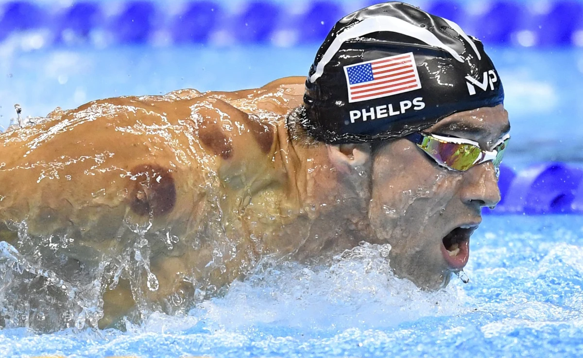 Na ciałach wielu, głównie amerykańskich, sportowców startujących w Rio można zobaczyć okrągłe plamy. Doskonale było je widać chociażby na plecach złotego medalisty Michaela Phelpsa. Okazuje się, że owe zaczerwienienia to efekt uboczny... stawiania baniek. A bańki są hitem tegorocznych igrzysk. 