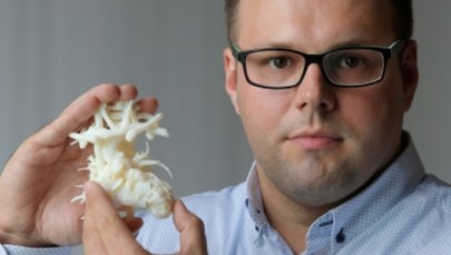 Programista wydrukował model 3D serca chorego synka, by pomóc kardiochirurgom