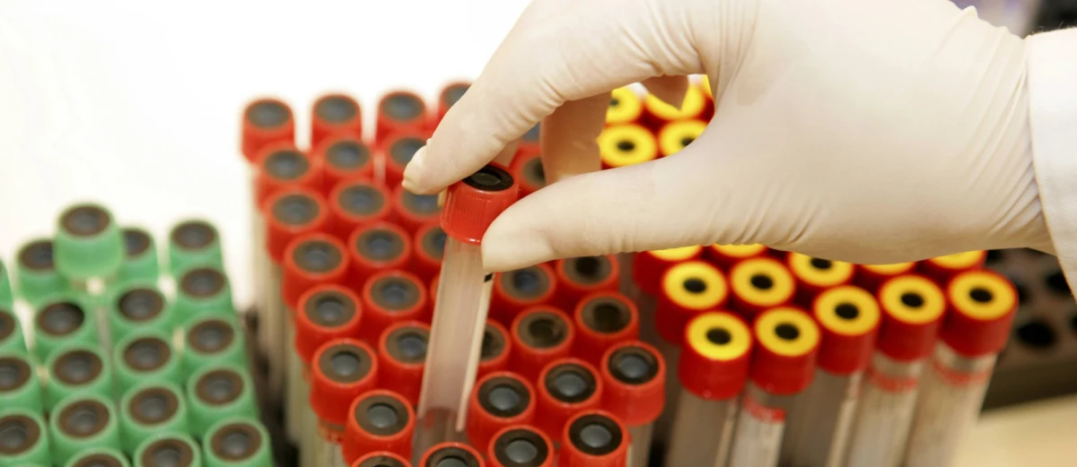 Rosja oficjalnie przyznaje: w Jekaterynburgu panuje epidemia HIV. Nosicielem wirusa jest co 50. mieszkaniec miasta - informuje nasz rosyjski korespondent Przemysław Marzec.