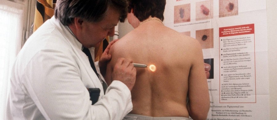 ​Polska jest w europejskiej czołówce pod względem liczby zachorowań na nowotwory skóry - alarmuje Polska Unia Onkologii. Jednymi z najczęściej występujących nowotworów są czerniak oraz rak podstawnokomórkowy. Co roku czerniaka lekarze diagnozują u ponad 3 tysięcy Polaków.