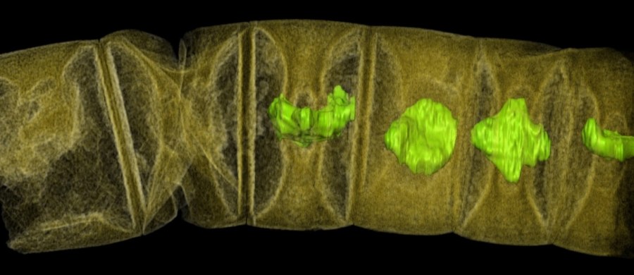 Naukowcy Swedish Museum of Natural History kolejny raz cofnęli czas. Odkryli szczątki glonów sprzed 1,6 miliarda lat. Ich praca, opublikowana na łamach czasopisma "PLOS Biology" wskazuje, że złożone, wielokomórkowe organizmy pojawiły się na Ziemi się znacznie wcześniej, niż myśleliśmy. To kolejne w ostatnich miesiącach odkrycie, które przesuwa daty początków życia. Nie dalej jak w październiku badacze z Instytutu Paleobiologii PAN w Warszawie ogłosili na łamach czasopisma "Precambrian Research" odkrycie szczątków organizmów jądrowych sprzed ponad 2,7 miliardów lat, miliard lat wcześniejszych, niż najstarsze znane do tej pory. Teraz mówimy jednak o życiu znacznie bardziej zorganizowanym.