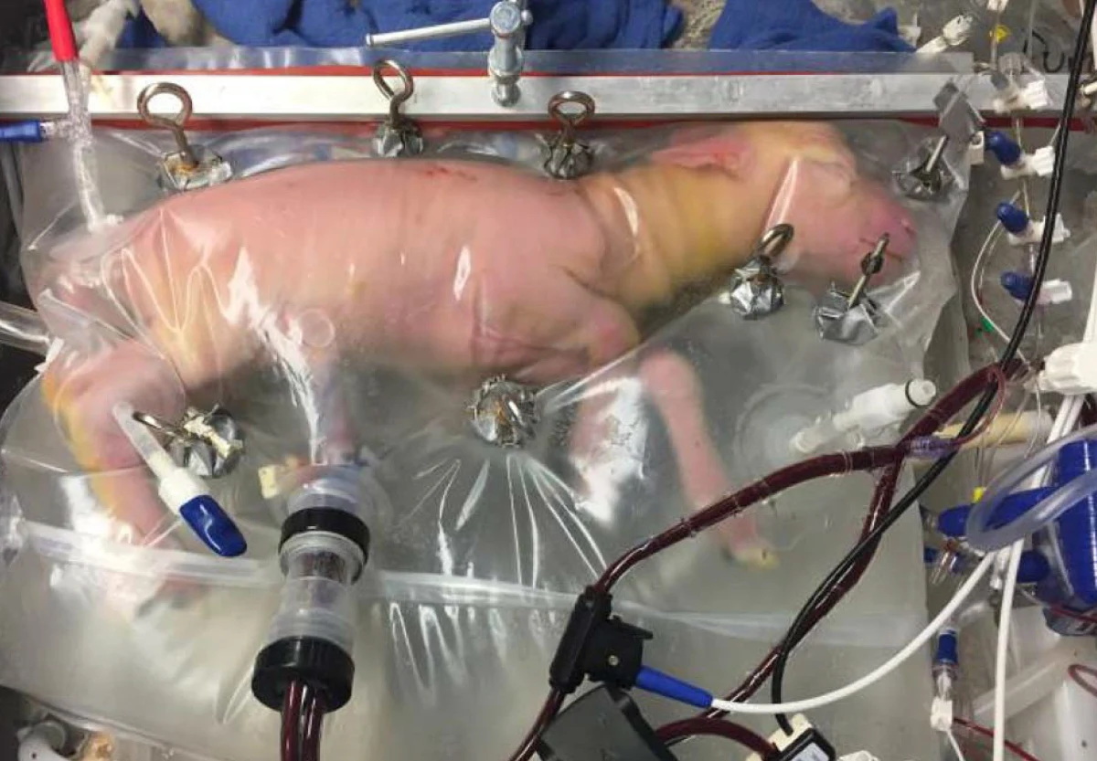 Nowa szansa dla wcześniaków? Naukowcy z Children’s Hospital w Filadelfii opracowali metodę, która może pomóc im rozwijać się w znacznie korzystniejszych warunkach niż inkubator. Jak informuje na swej stronie internetowej czasopismo "New Scientist", badacze z Pensylwanii przeprowadzili pomyślne testy modeli sztucznej macicy w postaci plastikowych worków wypełnionych odpowiednim płynem. Przedwcześnie urodzone jagnięta, przetrzymywane w nich przez okres czterech tygodni, rozwijały się całkiem normalnie. Kluczowe znaczenie miała aparatura zapewniająca im dostęp tlenu.