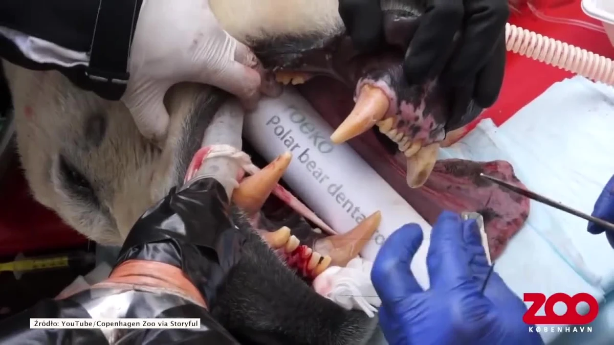 Pracownicy kopenhaskiego zoo wezwali dentystę do niedźwiedzia polarnego o imieniu Nord. Jak się okazało, ich podopieczny miał złamany ząb i zaawansowaną próchnicę. Znieczulony wcześniej miś przeszedł specjalny zabieg. Opiekunowie niedźwiedzia poinformowali, że wszystko przebiegło pomyślnie. Dwa zęby usunięto, jednak w przyszłym miesiącu Nord będzie potrzebował kolejnej ingerencji dentystycznej. Niedźwiedź polarny do ogrodu zoologicznego w Kopenhadze został przywieziony w kwietniu z Rosji.