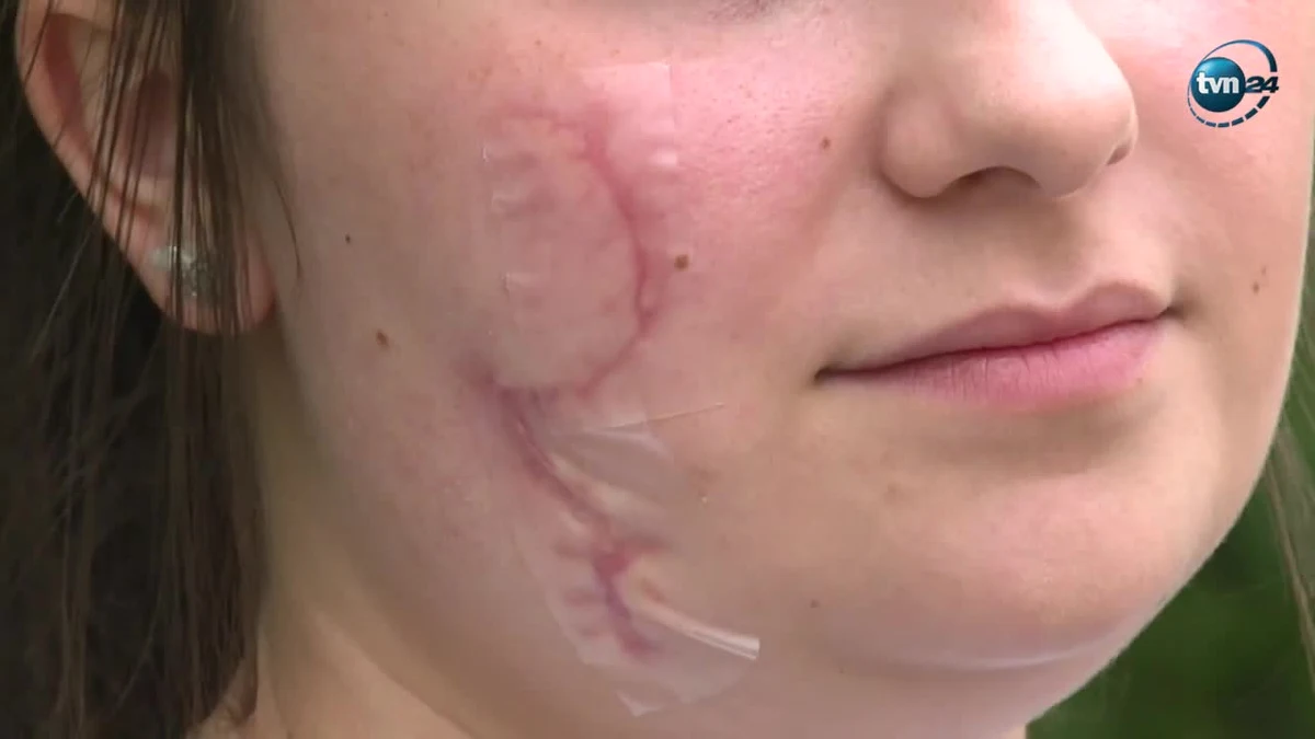 Policja zatrzymała drugą osobę w sprawie ataku rozbitą butelką na dwie młode kobiety w Katowicach. To mężczyzna, który brał udział w bójce tuż przed tym zdarzeniem. Od wczoraj w rękach policji jest także 26-latek, który zadał ciosy.