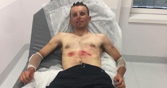 Rafał Majka wycofał się dalszej rywalizacji w Tour de France. Polak podczas niedzielnego etapu upadł i z trudem dojechał do mety.