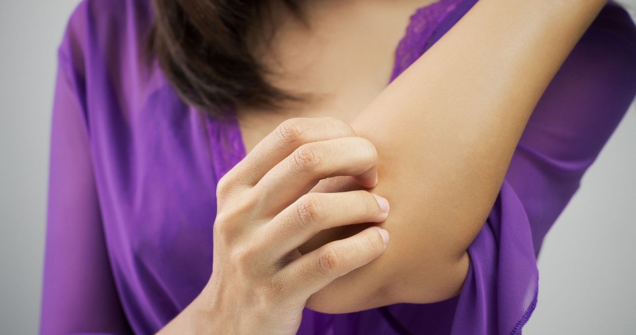 Nie wszyscy wiedzą, iż są uczuleni. Powoduje świąd, obrzęk i kłopoty z oddychaniem