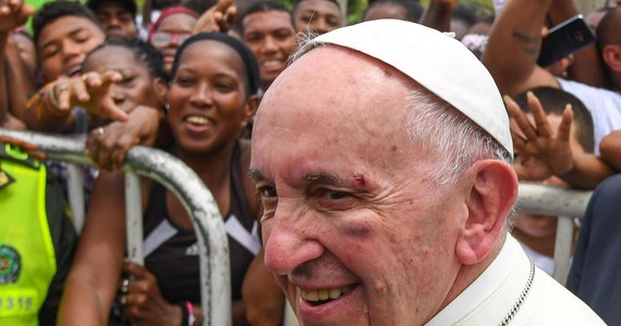 ​Papież Franciszek podczas przejazdu w papamobile ulicami miasta Cartagena w Kolumbii uderzył głową o metalową rurkę w pojeździe, gdy stracił równowagę w chwili gwałtownego hamowania. Na zdjęciach widać siniak i małą ranę na twarzy papieża.