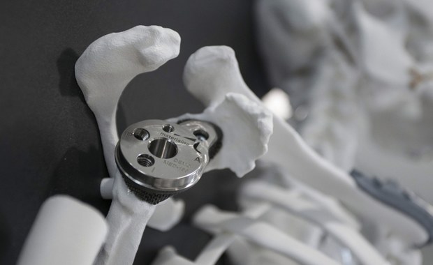 Naukowcy z Uniwersytetu Mikołaja Kopernika w Toruniu pracują nad stworzeniem prototypu spersonalizowanego implantu nowej generacji, wytwarzanego w technologii 3D. Już pod koniec października planowane są pierwsze wszczepy. Projekt jest nowatorski na skalę światową.