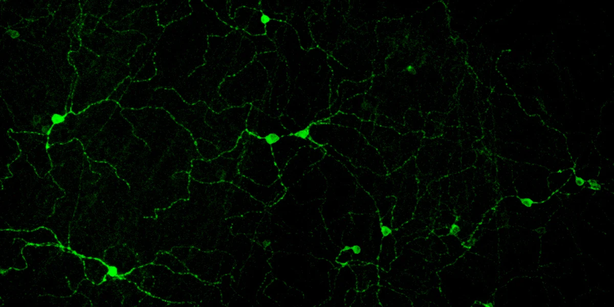 Nasze oczy mają niezwykłe zdolności rejestrowania oświetlenia o bardzo różnym poziomie natężenia. Są w stanie rozpoznawać zarówno gwiaździstą noc, jak i jasny dzień. Odbywa się to jednak w nieco inny sposób, niż do tej pory przypuszczaliśmy. Okazuje się, że od różnych pór dnia i nocy mamy różne zestawy komórek. Piszą o tym na łamach czasopisma "Cell" neurolodzy z Boston Children's Hospital. Ich odkrycie może pomóc w lepszym zrozumieniu działania naszego zegara biologicznego.