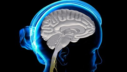 Co to jest udar mózgu?