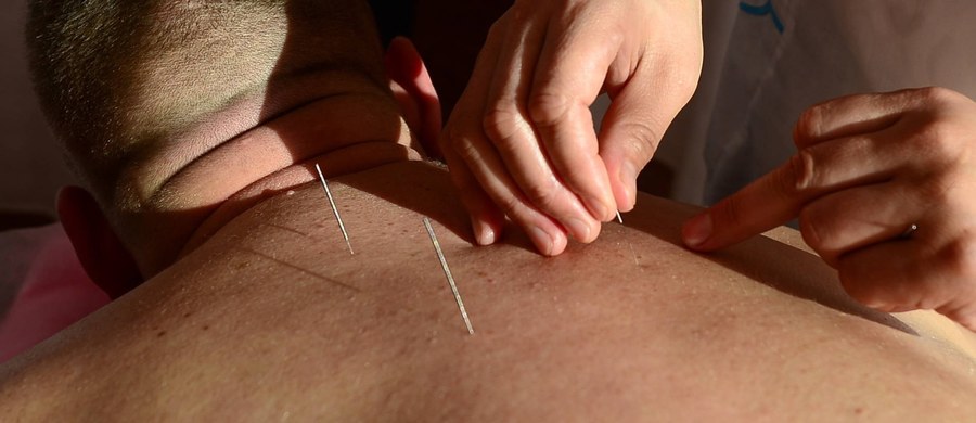 Twórca i szef Poradni Leczenia Bólu w USK we Wrocławiu prof. Andrzej Kuebler ocenia, że akupunktura jest metodą dobrze uzupełniającą najczęściej stosowane formy zwalczania bólu. W Polsce ta metoda nadal nie jest powszechną praktyką.