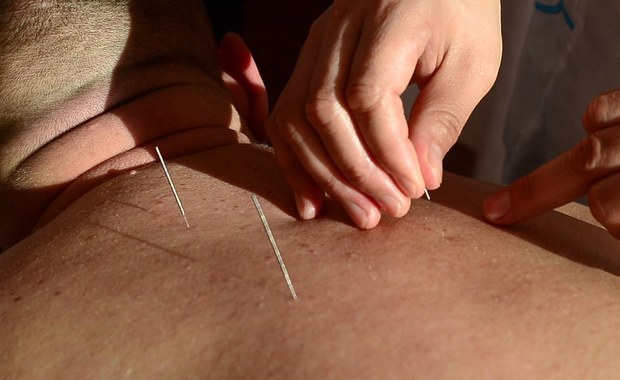 Twórca i szef Poradni Leczenia Bólu w USK we Wrocławiu prof. Andrzej Kuebler ocenia, że akupunktura jest metodą dobrze uzupełniającą najczęściej stosowane formy zwalczania bólu. W Polsce ta metoda nadal nie jest powszechną praktyką.