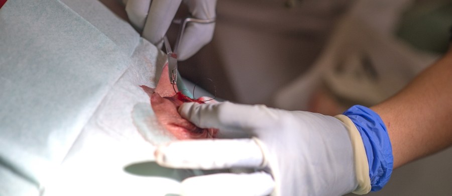 3546 lekarzy rezydentów i specjalistów wypowiedziało umowy, na mocy których wyrażali zgodę na przedłużenie czasu pracy powyżej 48 godzin tygodniowo. To najnowsze dane na temat wypowiadania klauzul opt-out przekazane przez biuro prasowe Ministerstwa Zdrowia. Medyczne związki mówią o ponad 5 tys. lekarzy, którzy złożyli takie wypowiedzenia.