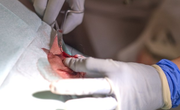 3546 lekarzy rezydentów i specjalistów wypowiedziało umowy, na mocy których wyrażali zgodę na przedłużenie czasu pracy powyżej 48 godzin tygodniowo. To najnowsze dane na temat wypowiadania klauzul opt-out przekazane przez biuro prasowe Ministerstwa Zdrowia. Medyczne związki mówią o ponad 5 tys. lekarzy, którzy złożyli takie wypowiedzenia.