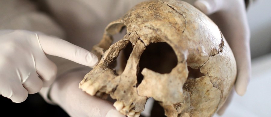 Szczątki siedmiu osób ze stożkowato wydłużonymi czaszkami odkryli archeolodzy w czasie wykopalisk w zachodnim Iranie. To efekt zabiegów, którym poddawali się mieszkańcy Iranu niemal 10 tys. lat temu - tak wynika z analiz dr. hab. Arkadiusza Sołtysiaka.