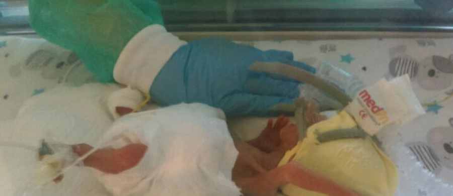 Urodzony w 25. tygodniu ciąży Szymek jest najmniejszym do tej pory wcześniakiem urodzonym w szpitalu klinicznym nr 2 na Pomorzanach. Jest też najmniejszym wcześniakiem w całym Szczecinie. Chłopiec miał zaledwie 30 cm długości i ważył 400 gramów. Dziś waży już ponad 2,5 kg i jeszcze w tym tygodniu będzie mógł wrócić z mamą do domu.