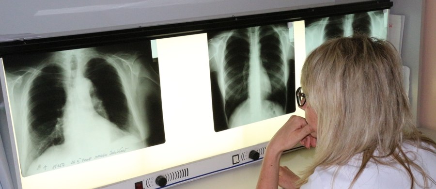 Wielu pacjentów obawia się prześwietleń rentgena, bo boją się, że promieniowanie może mieć negatywny wpływ na ich organizm. O wątpliwościach i o tym, dla jakich części ciała promienie mają negatywny wpływ mówi dr Małgorzata Mielnik z Zakładu Radiologii i Diagnostyki Obrazowej Krakowskiego Specjalistycznego Szpitala im. Jana Pawła II.