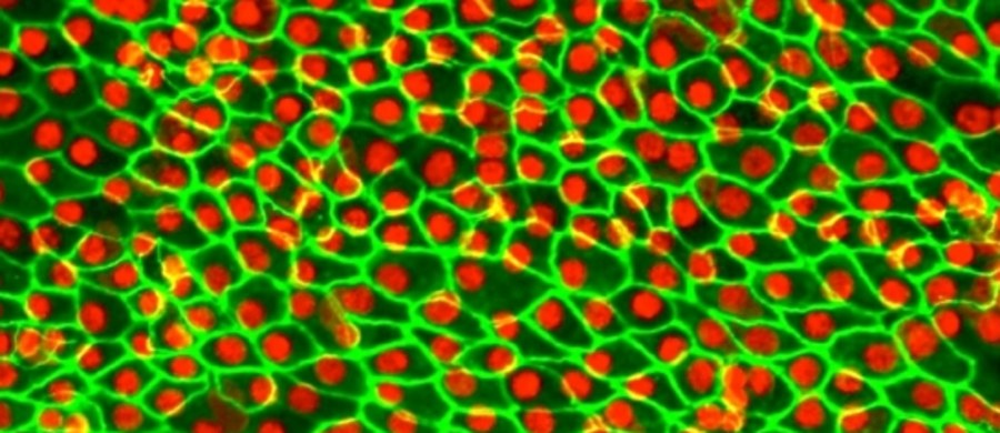 Pionierska metoda terapii, oparta na wykorzystaniu embrionalnych komórek macierzystych, przywróciła dwóm osobom, cierpiącym na zwyrodnienie plamki żółtej, możliwość czytania - informuje w najnowszym numerze czasopismo "Nature Biotechnology". Naukowcy z University College London i University of California w Santa Barbara z pomocą komórek macierzystych odtworzyli tak zwany nabłonek barwnikowy siatkówki, który po przeszczepieniu znacznie poprawił u pacjentów zdolność widzenia. 12 miesięcy po przeprowadzeniu zabiegu u żadnej z tych osób nie pojawiły się poważne efekty uboczne. Autorzy pracy mają nadzieję, że nowa terapia trafi do praktyki medycznej w ciągu pięciu lat.