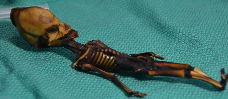 W 2003 roku w opuszczonym miasteczku na pustyni Atacama w Chile znaleziono niezwykłe szczątki: szkielet o długości zaledwie 15 centymetrów z nienaturalnie wydłużoną głową. Jego rozmiary wskazywały, że to szczątki płodu, wygląd kości - że cierpiącego na progerię dziecka wieku 6-8 lat. Internauci doszukiwali się w nim natomiast przedstawiciela obcej cywilizacji. Wyniki badań genetycznych, opublikowane dziś na łamach czasopisma "Genome Research", nie pozostawiają wątpliwości: to szkielet człowieka - przedwcześnie urodzonej, ciężko chorej dziewczynki.