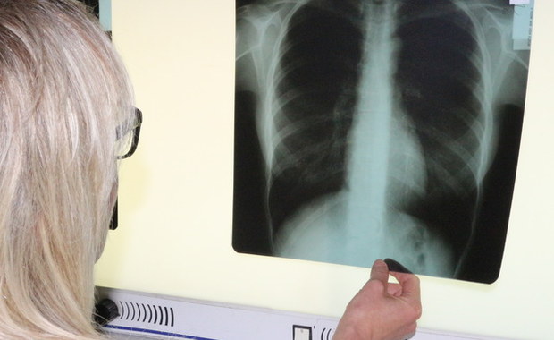 Rak płuca jest najczęściej występującym w naszym kraju nowotworem. Według Narodowego Funduszu Zdrowia, od 1 października tego roku, w pilotażowych ośrodkach możliwe jest wprowadzenie kompleksowej opieki w zakresie tej choroby. Powinno to poprawić wczesną diagnostykę oraz skuteczność leczenia tego nowotworu.