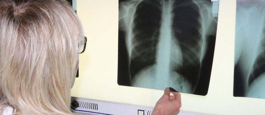 Szacuje się, że na przewlekłą obturacyjną chorobę płuc cierpi już 2 miliony Polaków. Tymczasem trzy czwarte z nich nie ma postawionej diagnozy choroby i nic nie robi, by spowolnić jej rozwój. Kampania „Płuca Polski” ma na celu podniesienie świadomości społeczeństwa na temat POChP. 