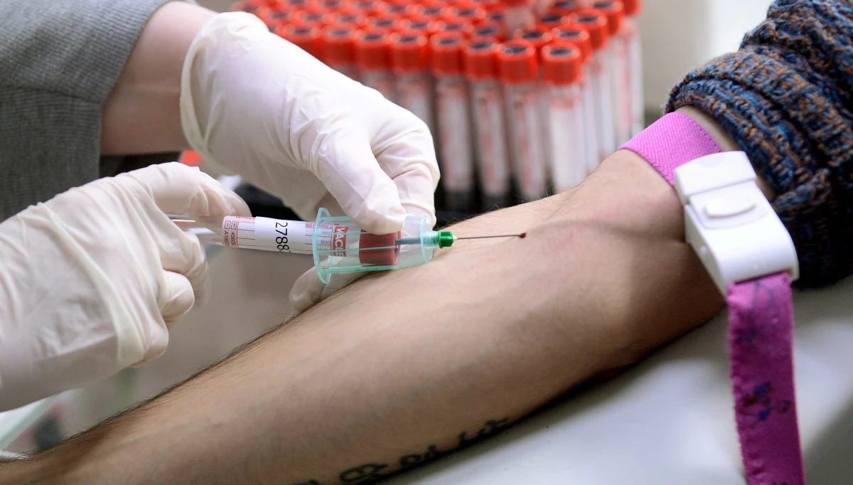 ​W Moskwie w 2017 roku zarejestrowano o 20 proc. więcej przypadków zakażenia wirusem HIV niż rok wcześniej. Informacje o tym przynosi rosyjskiego Ministerstwo Zdrowia.