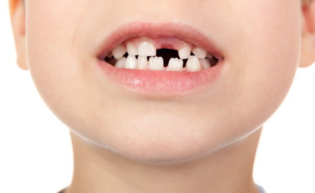 Wady wymowy, zahamowanie wzrostu kości oraz niepotrzebny ból – to tylko niektóre z nieprzyjemnych następstw braku odpowiedniej opieki nad mleczakami malucha. Część rodziców błędnie sądzi, że nie warto przejmować się zębami mlecznymi, skoro i tak wypadną. Ortodonta Kamila Wasiluk, przestrzega przed takim podejściem. Przedwczesna utrata zębów mlecznych, czyli na 3-4 lata przed terminem ich fizjologicznego wypadnięcia, prowadzi do przykrych konsekwencji w dorosłym życiu – stłoczeń zębowych, czy różnego rodzaju wad zgryzu. 