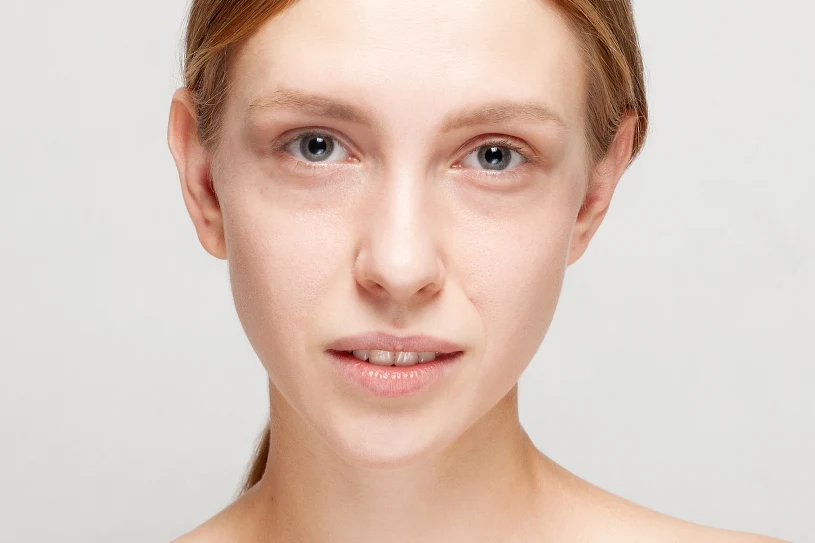 Dlaczego masz cienie pod oczami pomimo dobrego snu? Oto możliwe powody