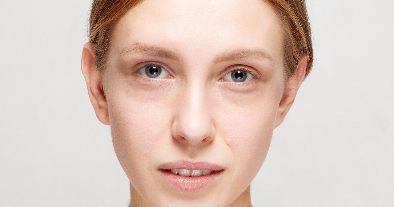 Dlaczego masz cienie pod oczami pomimo dobrego snu? Oto możliwe powody