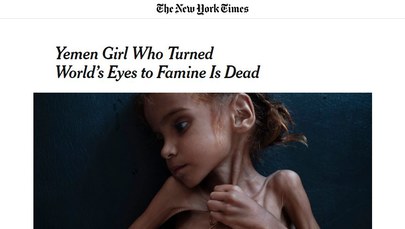 Zdjęcie Amal stało się symbolem głodu w Jemenie. Zmarła w wieku 7 lat