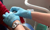 Rekordowa liczba zakażonych wirusem HIV