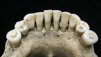 Zakonnica z niebieskimi zębami. Naukowcy rozwiązali średniowieczną zagadkę