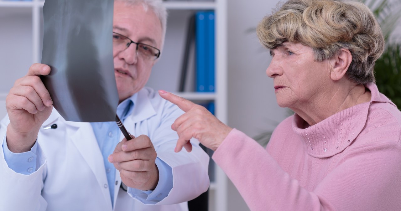 Choruje 20 tys. Polek i Polaków rocznie. Nowotwór płuc, który rozwija się latami
