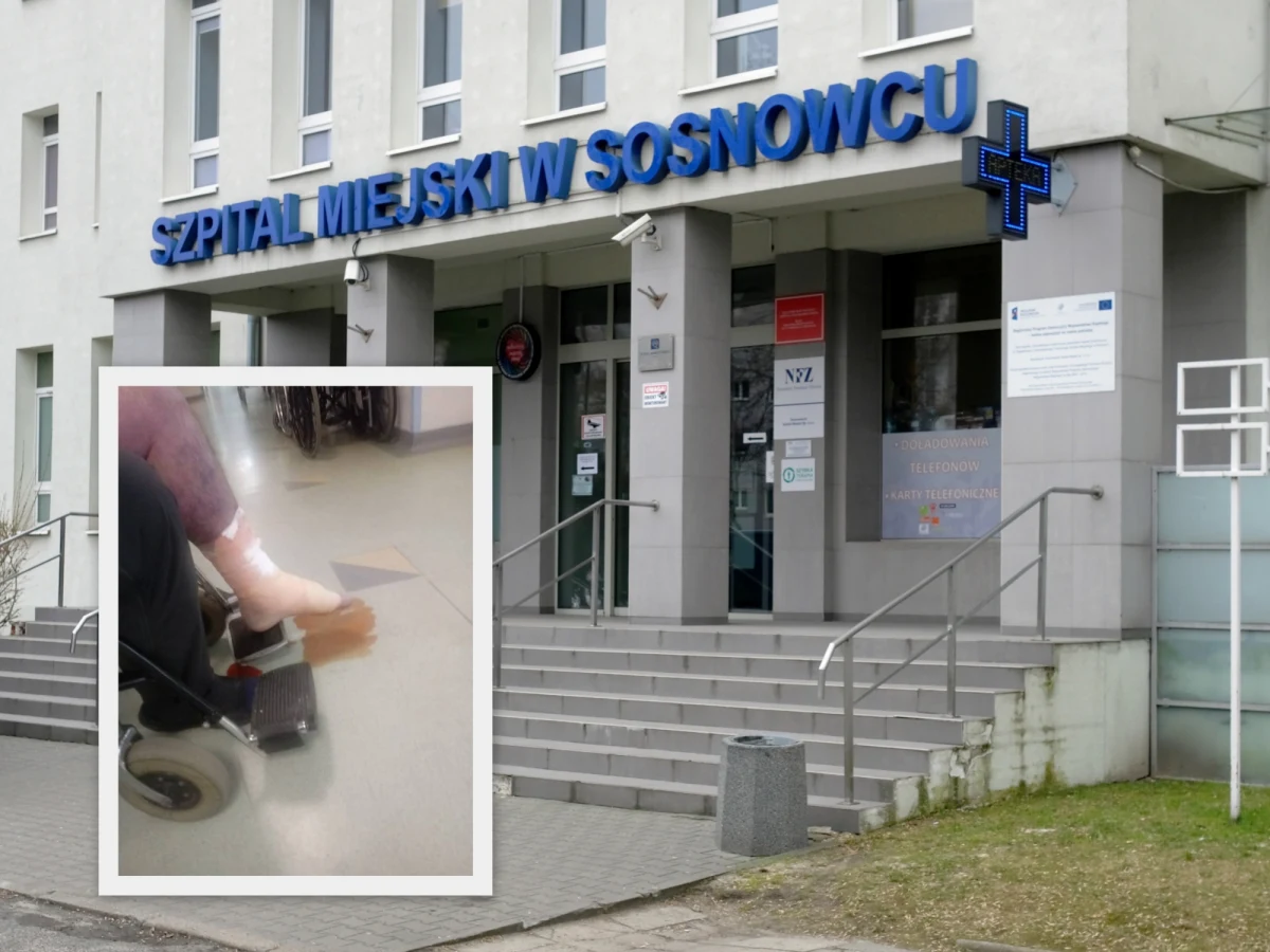 Narodowy Fundusz Zdrowia skontroluje Sosnowiecki Szpital Miejski po śmierci 39-latka w izbie przyjęć. Mężczyzna z siną i spuchniętą nogą czekał na pomoc 9 godzin. Zmarł o godzinie 22.