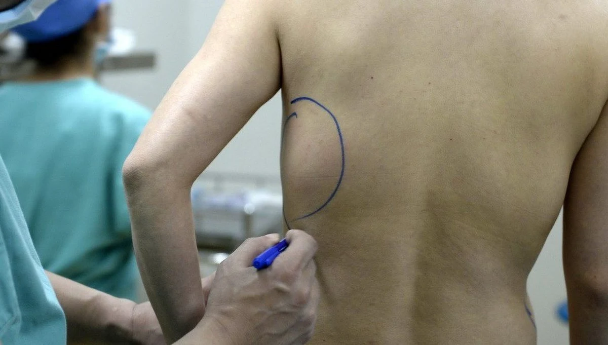 ​W rosyjskim Krasnodarze zatrzymano chirurg plastyczną Alienę Werdi, nazywaną przez media "doktorem Frankesteinem". Wielu jej pacjentów zostało oszpeconych, a niekiedy nawet trafiali do szpitali.