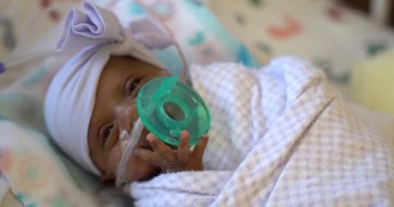 W szpitalu w San Diego przyszło na świat najmniejsze zdrowe dziecko w dziejach udokumentowanej medycyny - podało kierownictwo szpitala porodowego Sharp Mary Birch Hospital. Dziewczynka, która przyszła na świat w styczniu, ważyła 243,8 grama.