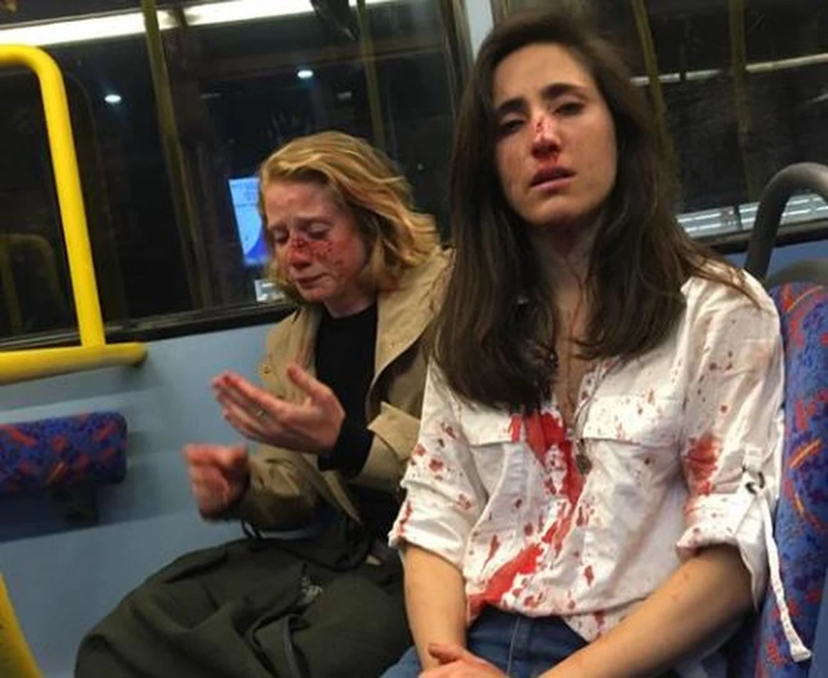 Czterech nastolatków zostało zatrzymanych za atak homofobiczny w Londynie. Pobili oni lesbijki, wracające w nocy autobusem do domu. 