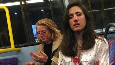 Para lesbijek pobita w autobusie w Londynie. "Obrzydliwy, mizoginiczny atak"