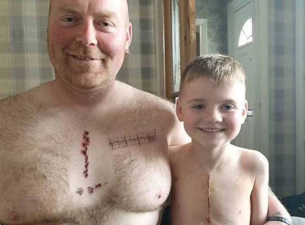 6-letni Joey przeszedł ratującą życie operację serca. Jego tata Martin chciał go wesprzeć w tych ciężkich chwilach. Kazał sobie zrobić tatuaż przedstawiający pooperacyjną bliznę synka.