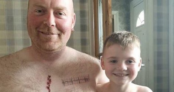 6-letni Joey przeszedł ratującą życie operację serca. Jego tata Martin chciał go wesprzeć w tych ciężkich chwilach. Kazał sobie zrobić tatuaż przedstawiający pooperacyjną bliznę synka.
