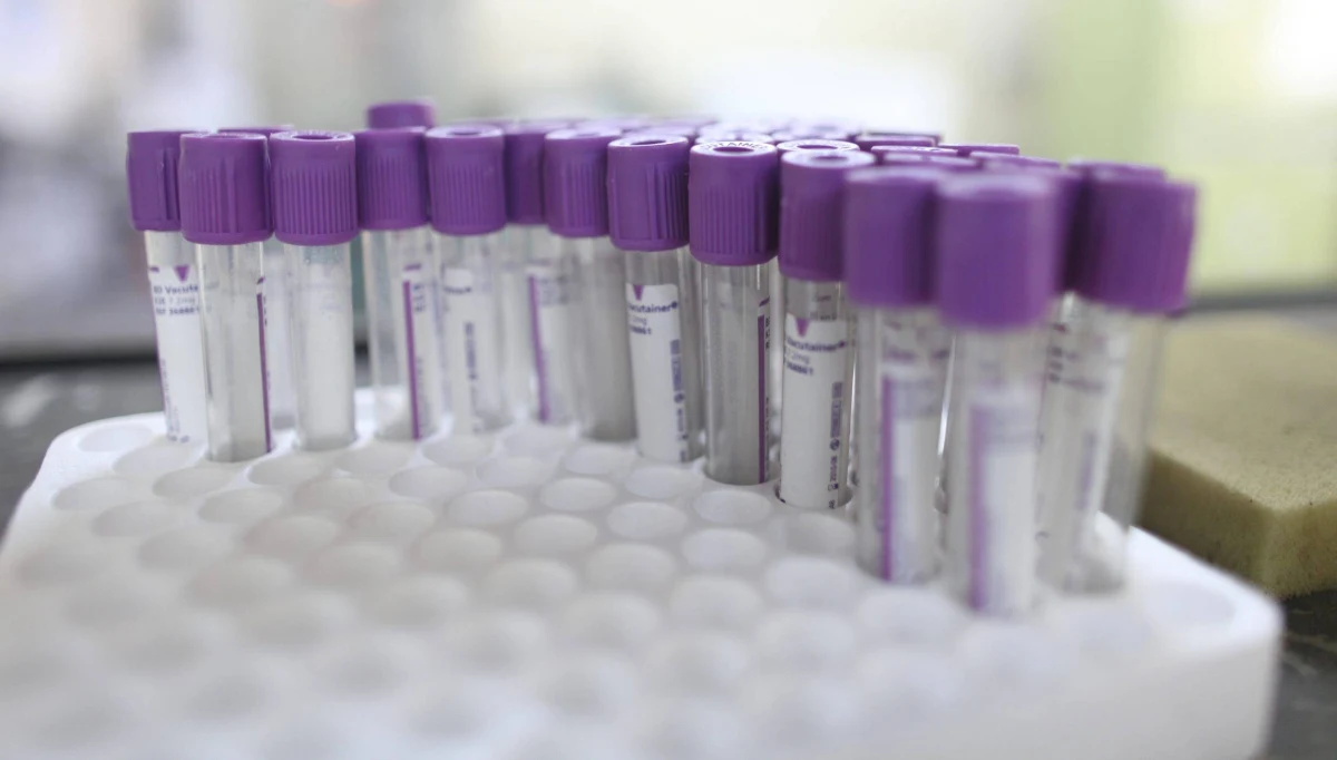 ​Ponad milion nosicieli wirusa HIV w Rosji, liczba chorych rośnie. W 2018 roku wyjawiono blisko 90 tysięcy nowych zarażonych.