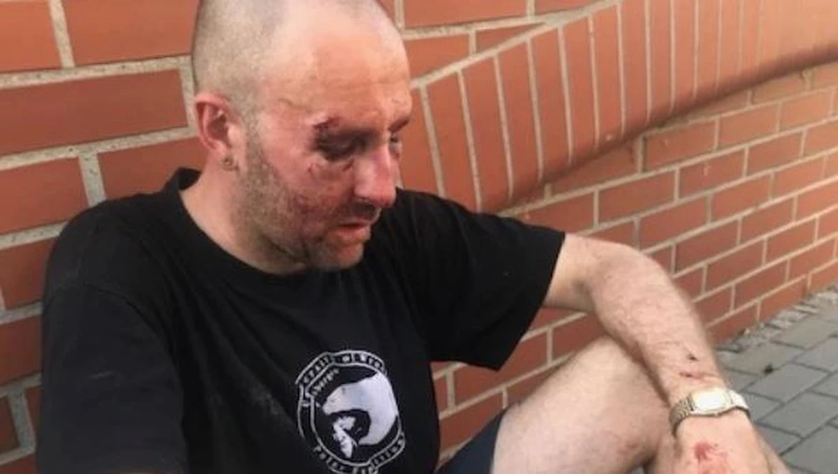 Niech państwo polskie zachowuje się jak państwo, a nie jak państwo z tektury i zacznie reagować na samosądy i przemoc na ulicach – mówi Onetowi Przemysław Witkowski. Wczoraj dziennikarz i wykładowca Uniwersytetu Wrocławskiego został pobity. Całą noc spędził w szpitalu. Jak pisze Onet, ma złamania nosa, kości zatokowej, jarzmowej i szczękowej. Publicysta został zaatakowany, bo głośno powiedział, co myśli o homofobicznych napisach na bulwarach nad Odrą. Sprawcy ataku cały czas szuka policja. 