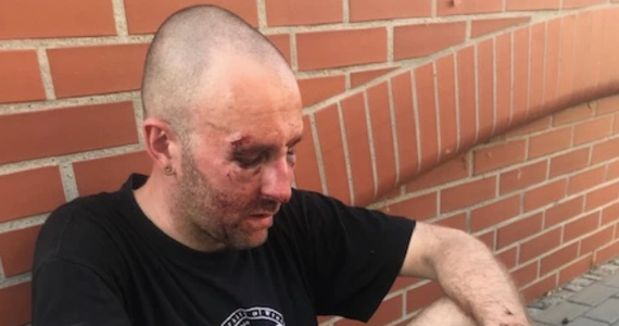 Wrocławska policja zatrzymała 28-letniego mężczyznę podejrzanego o pobicie dziennikarza i wykładowcy Uniwersytetu Wrocławskiego - Przemysława Witkowskiego. Do ataku doszło w czwartek na bulwarach nad Odrą. 