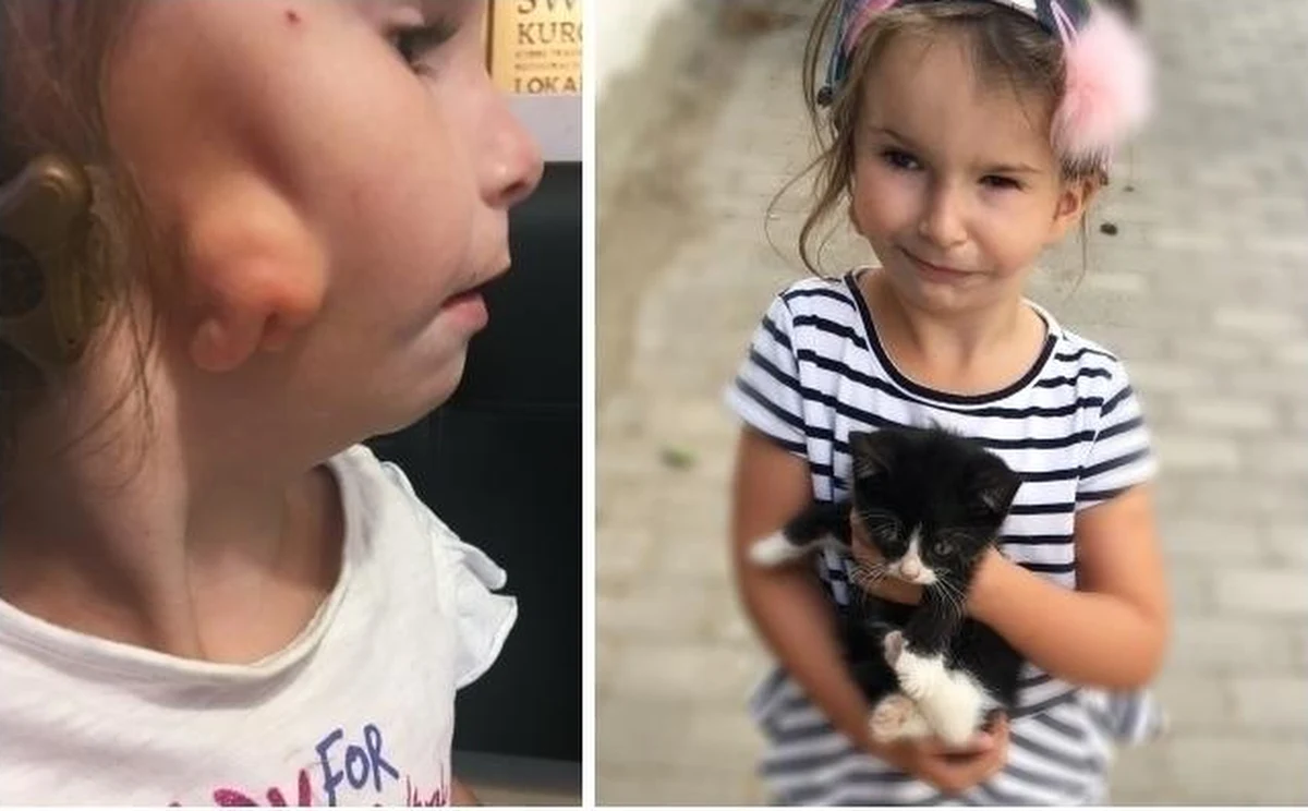 Puszkę pełna datków na leczenie 5-letniej Mai skradziono ze sklepu przy ul. Lipowej na szczecińskim Gocławiu. Sprawcy szuka teraz policja. Rodzice chorego dziecka apelują o zwrot pieniędzy. Próbują uzbierać 300 tysięcy złotych na operację zniekształconej przez chorobę twarzy 5-latki. 